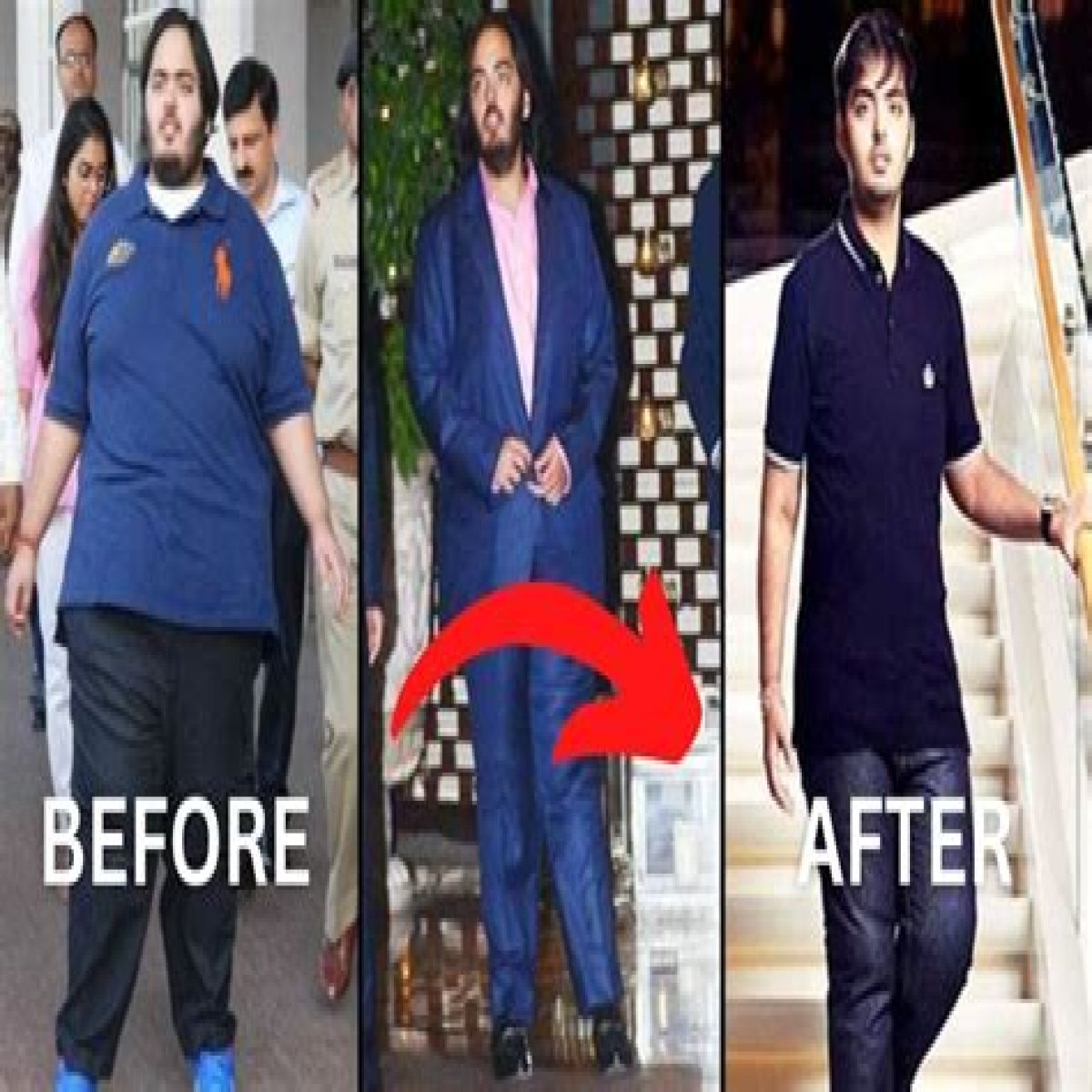 Anant Mukesh Ambani's Health Challenges: An Insightful Overview