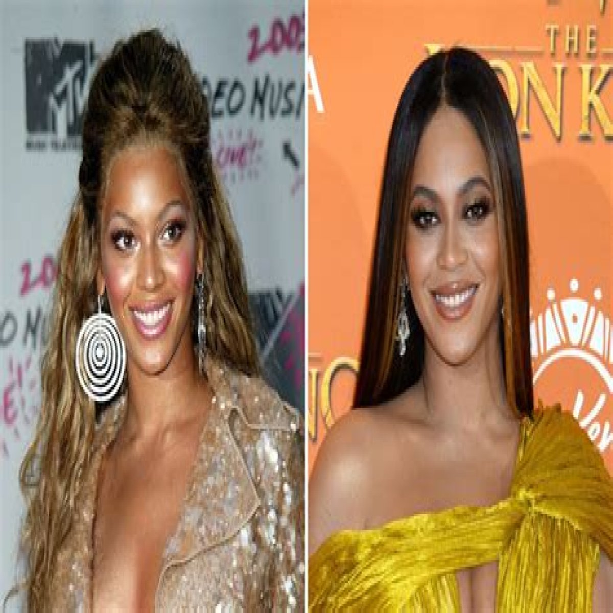 Did Beyonce Get Plastic Surgery? Why Fan Think the Singer Has Denied Rumors: Transformation Photos