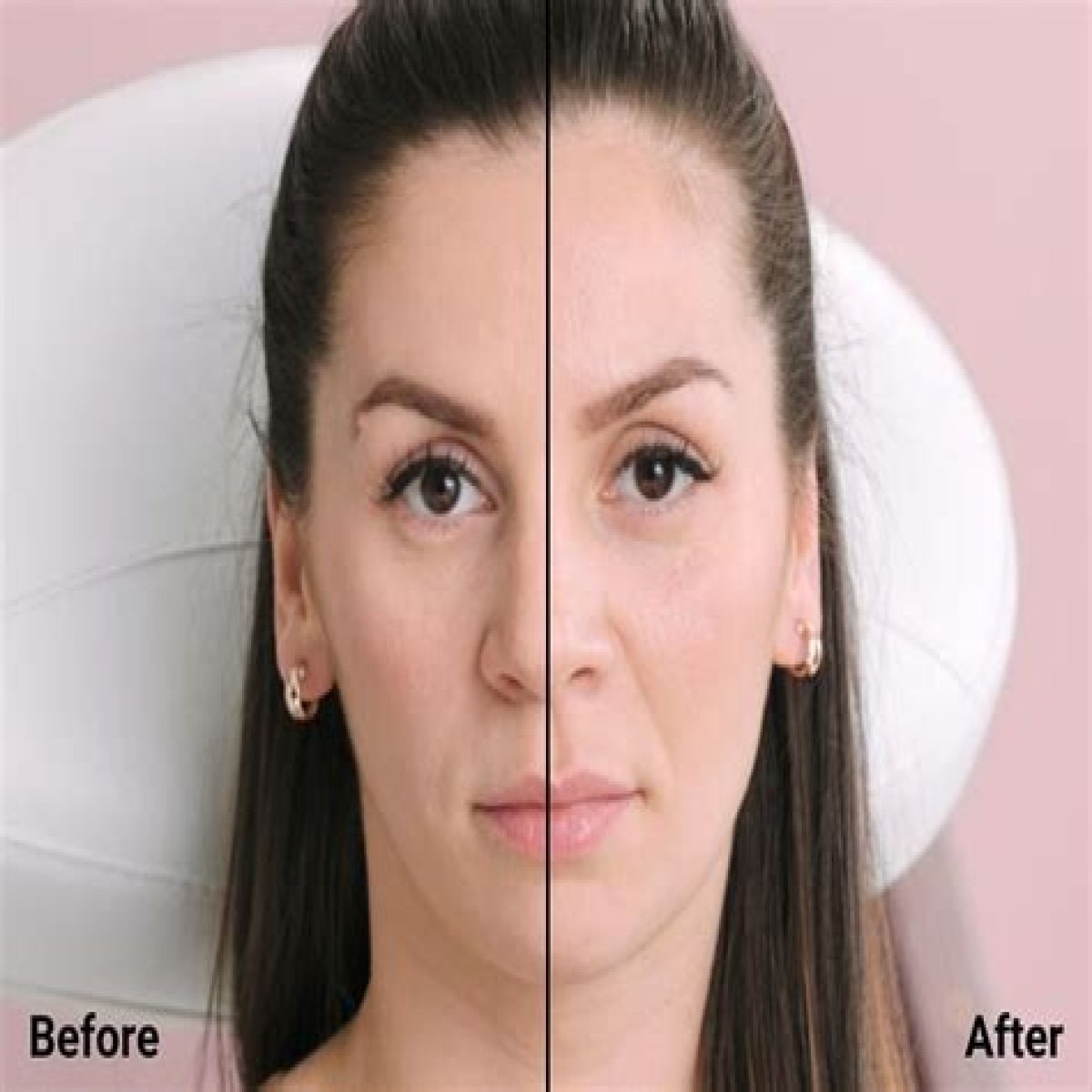 Everything You Need To Know About The ‘Hair Fillers’ Trend