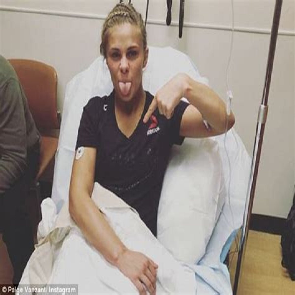 Paige VanZant reveals horrific 'shattered' arm which needed surgery and left her with brutal scar after UFC fight