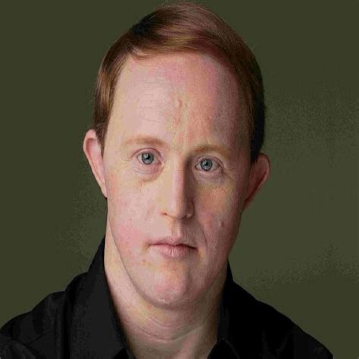 Remembering Chris Burke: A Tribute To His Life And Legacy