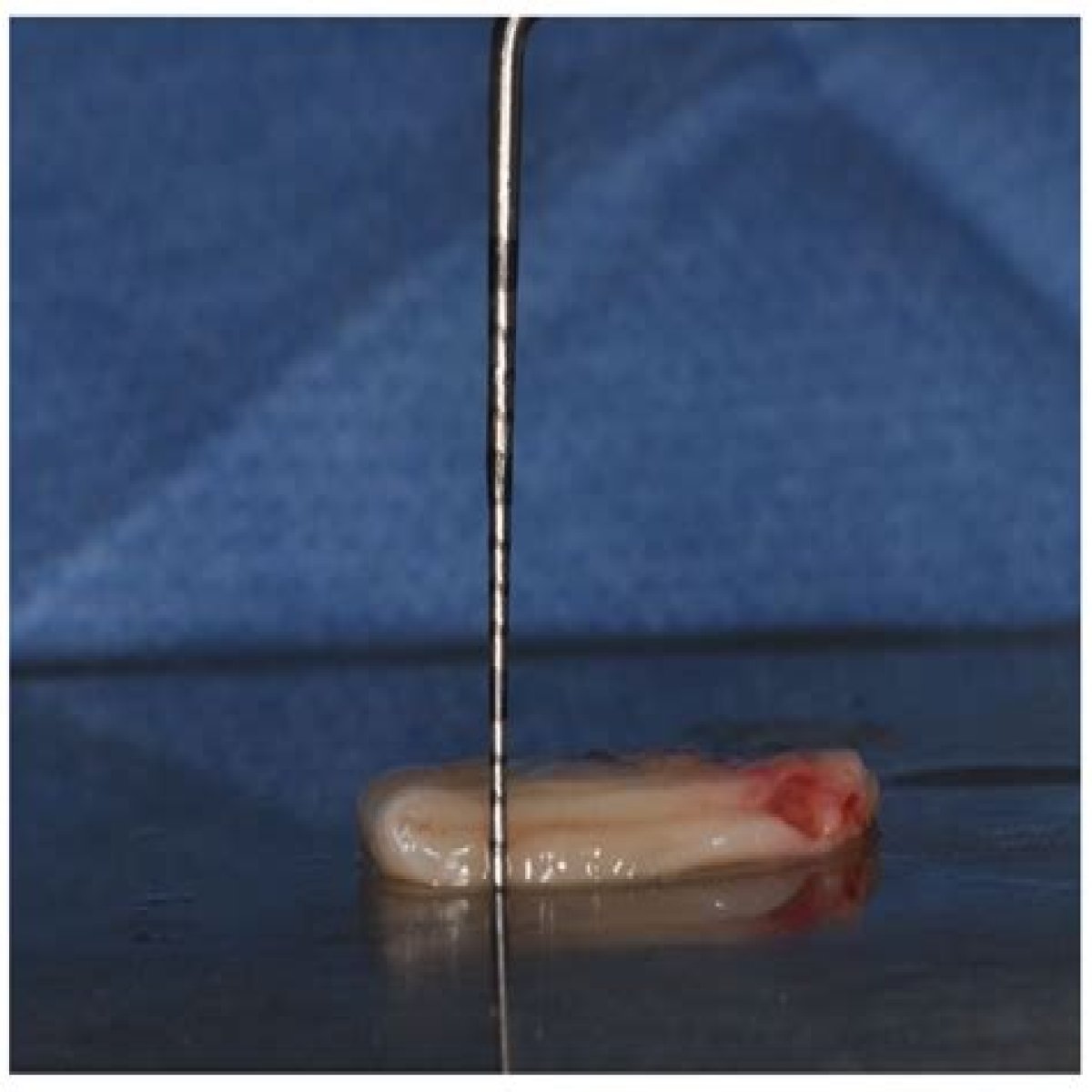 Uncovering The Surgical Enhancements Of Sabrina: Fact Or Fiction?