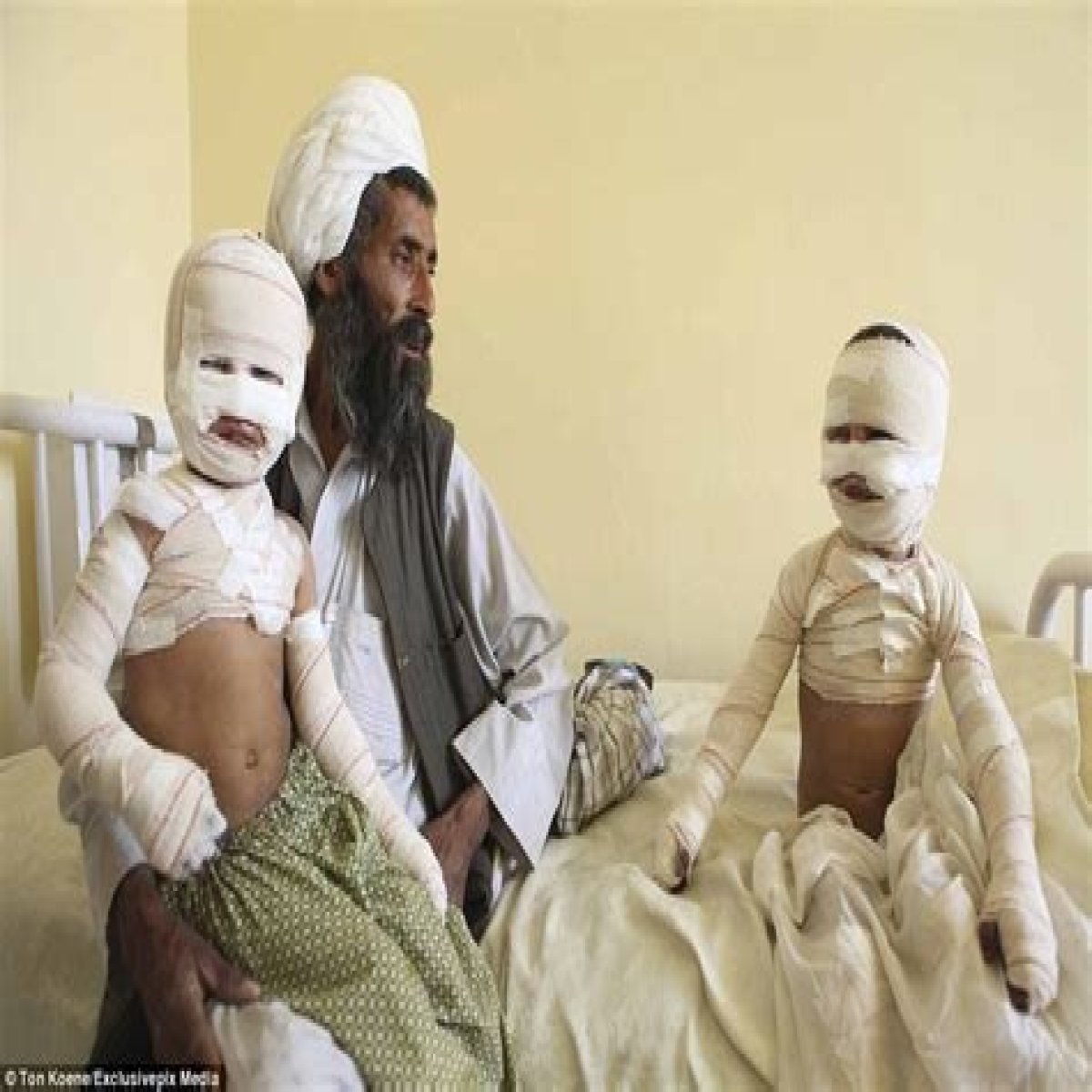 Yes, these pictures of war victims are shocking - but we MUST look at them
